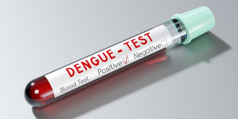 Obraz premium Dengue virus - test tubes, blood tests - 3D illustration