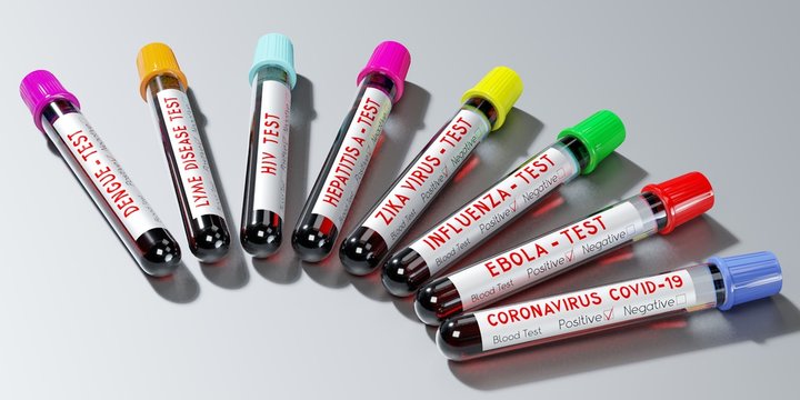 Various virus test tubes - 3D illustration