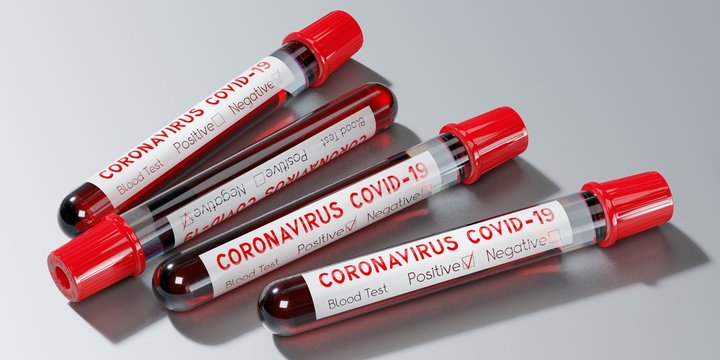 Coronavirus, SARS-CoV-2, Covid-19 virus - test tubes, blood tests - 3D illustration