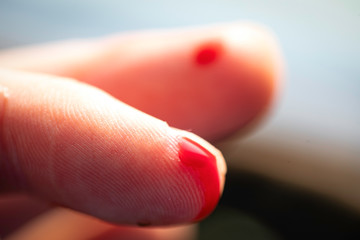 Finger cut, bleeding injured with knife, Flesh blood wound in hand