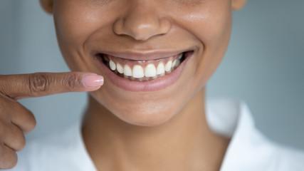 Close up african woman point finger at perfect straight hollywood white toothy smile. After...