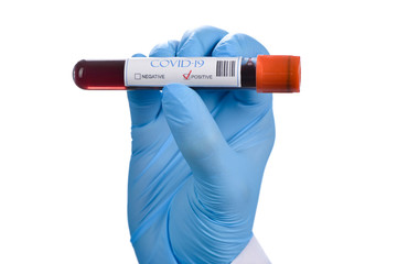 COVID-19 or Coronavirus Positive Blood Test 