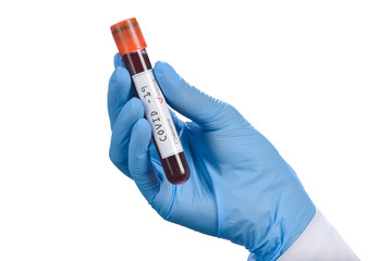 Blood sample tested COVID-19 positive.   