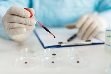 Close up view of a researcher's hands in a laboratory drips a blood sample into a Petri dish. Focus on the dropper.