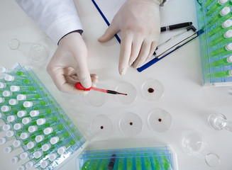 Top view of a researcher's hands in a laboratory drips a blood sample into a Petri dish. Focus on the dropper.