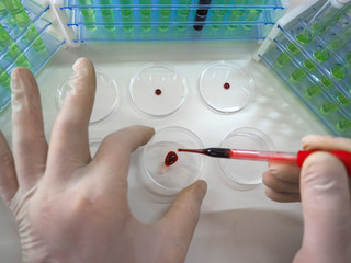 Photo of a pipette in a researcher's hands dripping a blood sampe in a Petri sish. Vaccine creation.