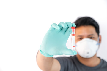 coronavirus covid 19 infected blood sample in In hand Believer of scientist with biohazard...