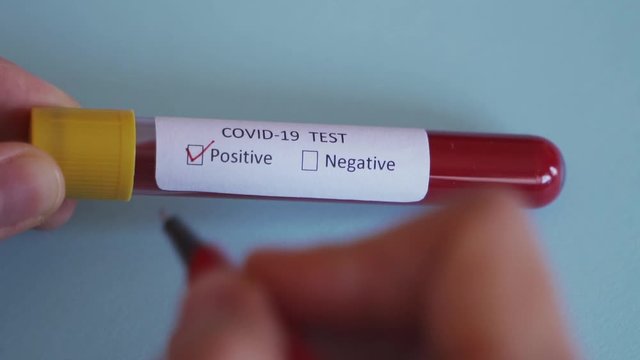 Hand checking the box Positive result on Test vial with Sample blood test of Coronavirus (Covid-19), Coronavirus Covid 19 infected blood sample. 