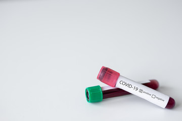 medicine, health care, pandemic and microbiology concept - coronavirus covid-19 blood test tubes over white background with copy space