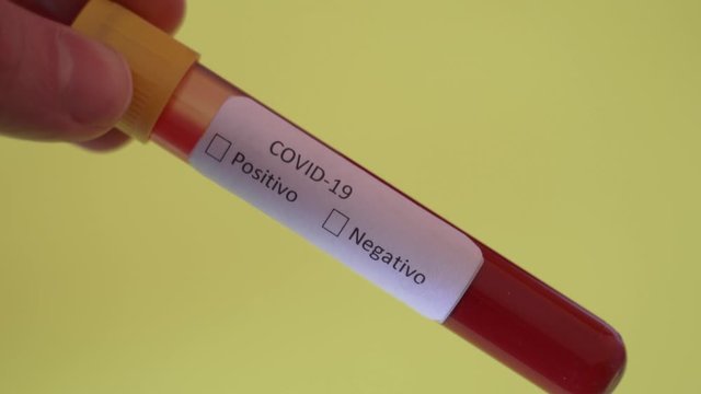 Hand in blue glove holding Test vial with Sample blood test of Coronavirus (Covid-19), Coronavirus Covid 19 infected blood sample