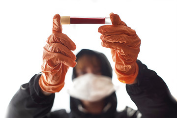Coronavirus. Sars-Co-2. Sars - 19. SARS-CoV-2. Infektions Test.