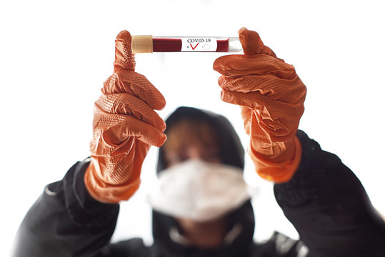 Virus Corona. Sars-Co-2. Sars - 19e SARS-CoV-2. Test d'infection.