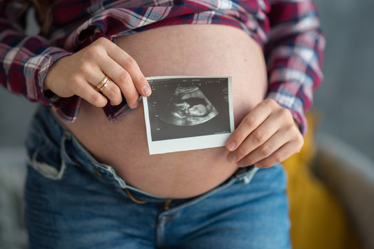 pregnant woman holding a picture of an ultrasound picture of a baby