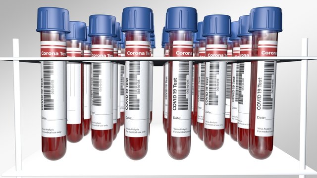 Covid19-Test tubes - Medical Corona Virus Test - visualization