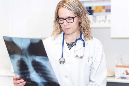 Covid-19. Female doctor holding X-ray of the lungs of a patient. Concept of detection of lung diseases, diagnosis of pneumonia and coronovirus .
