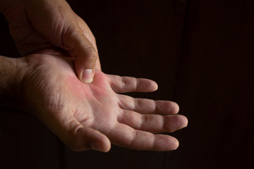 A man's hand squeezing the joint of the fifth finger. Joint pain in the right hand. Black background.