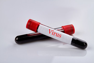 Blood test tubes with virus samples. White reflective table surface. Plasma in research laboratory.