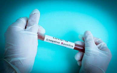 Fototapeta premium Hand holds a test tube containing a blood sample