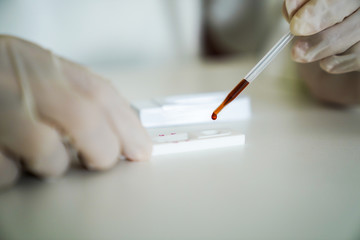 Doctors conducted a Coronavirus covid-19 vaccine blood test kit.