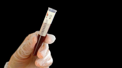 Fototapeta premium Scientist holding test tube with with positive results to CORONAVIRUS COVID-19 on black background.