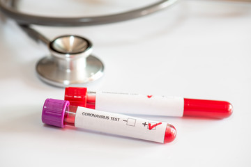 The blood sample tubes were sent to test for the covid-19 virus in a hospital laboratory.