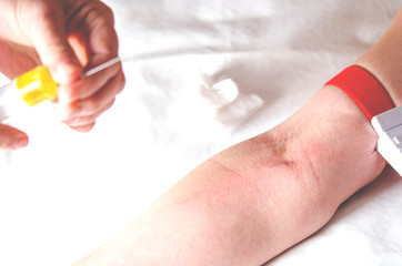 A woman's hand when hooked to intravenous infection and blood test