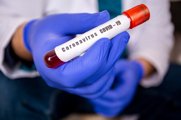 2019-nCoV Coronavirus. Positive Blood Sample in Doctors Hand. Respiratory Syndrome. Coronavirus outbreaking