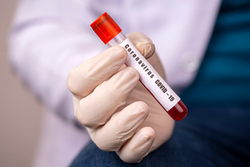 Fototapeta premium 2019-nCoV Coronavirus. Positive Blood Sample in Doctors Hand. Respiratory Syndrome. Coronavirus outbreaking