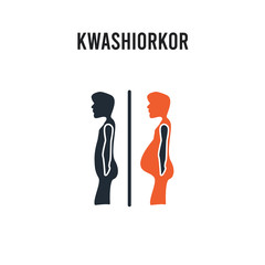 Kwashiorkor vector icon on white background. Red and black colored Kwashiorkor icon. Simple element illustration sign symbol EPS