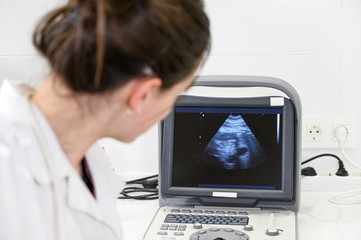 Doctor watching Ultrasound or Sonogram screen in the Hospital .
