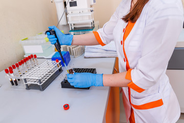 Rack of blood tubes test for analysis in the laboratory of hematology. Pneumonia diagnosing....