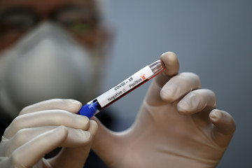 Obraz premium Coronavirus testing - A hand holds a test tube containing a patients sample that has tested positive for coronavirus