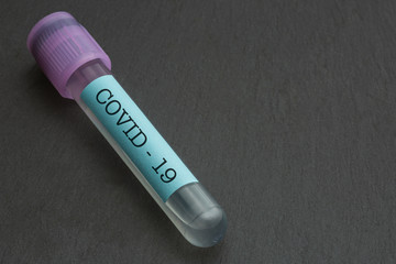 Test tube with sample of the patient