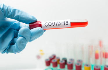 The microbiologist holds a test tube with a blood test for coronavirus Covid-19.