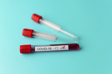 Positive blood test result for the new rapidly spreading Coronavirus