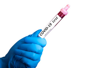 Sample blood test of Coronavirus (Covid-19) in hand with blue glove. Coronavirus Covid 19 blood...