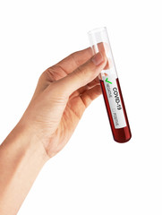 Coronavirus Covid 19 blood sample in sample tube in hand