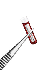 Coronavirus Covid 19 blood sample in sample tube in tweezers
