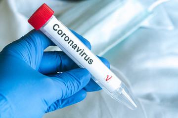 Fototapeta premium COVID-19 test. Hand in gloves holds a test tube with a corona virus test label. Inspirational respirator in the background. SARS-CoV-2 test concept.