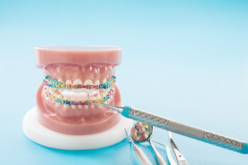 orthodontic model and dentist tool - demonstration teeth model of varities of orthodontic bracket...