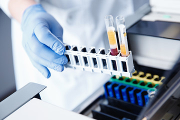 Nurse microbiologist holding test tube with blood for coronavirus 2019-nCoV analyzing