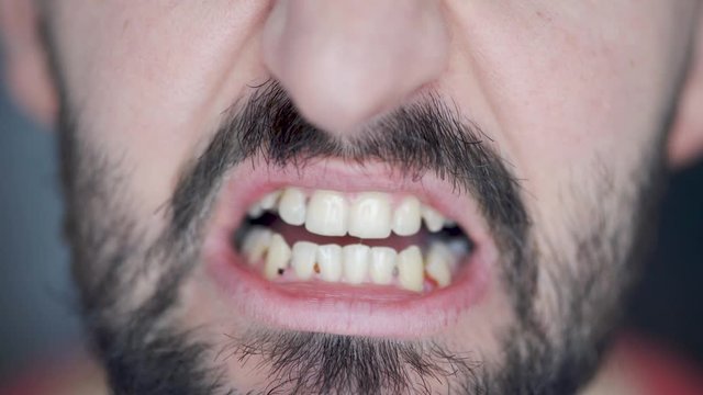 Caucasian male with black facial hair opens his mouth and shows dirty teeth.