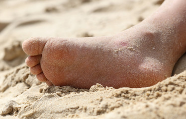 Feet of men in the sand of a beach.