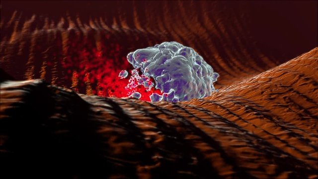 Realistic 3D-Illustration of a white blood cell, a leukocyte, causing inflammation by emitting inflammatory agents (e.g. histamine) into the tissue.