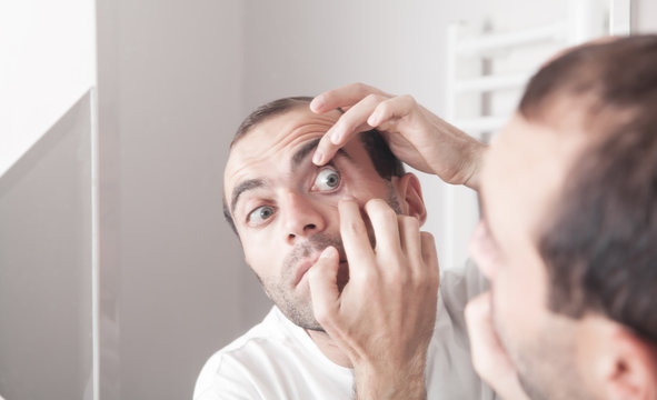 Caucasian Man Examining His Eye In Mirror.