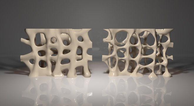 3d Illustration of Comparison Between Healthy Bone and Osteoporosis