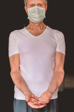 ill elderly man with  phlebitis in the arms
