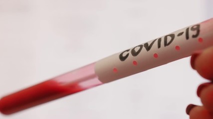 Woman holds in hands test tube with red liquid and inscription Covid-19. Acute Respiratory Virus Infection. Illness cold flu. Pandemic. Global spread of coronavirus. - Powered by Adobe