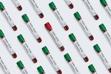 Closeup of medicine test tubes with blood samples: positive and negative coronavirus tests. Flat...