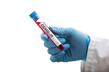 Obraz premium Microbiologist with a tube of biological sample contaminated by Coronavirus with label Covid-19